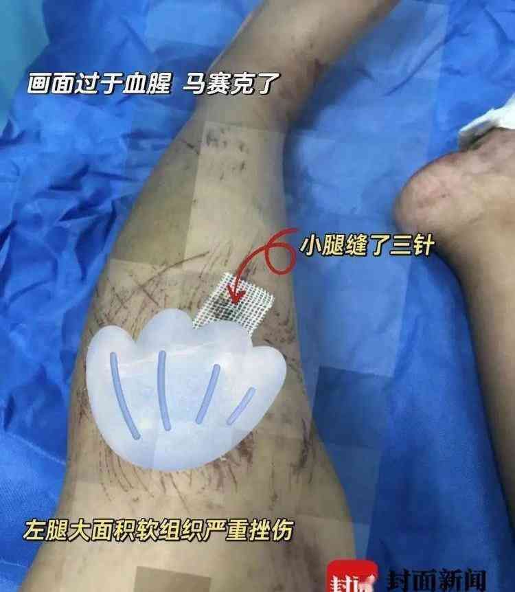 我在巴厘岛的亲身体验（巴厘岛恐怖经历：生死一线间的惊险体验）(图2)