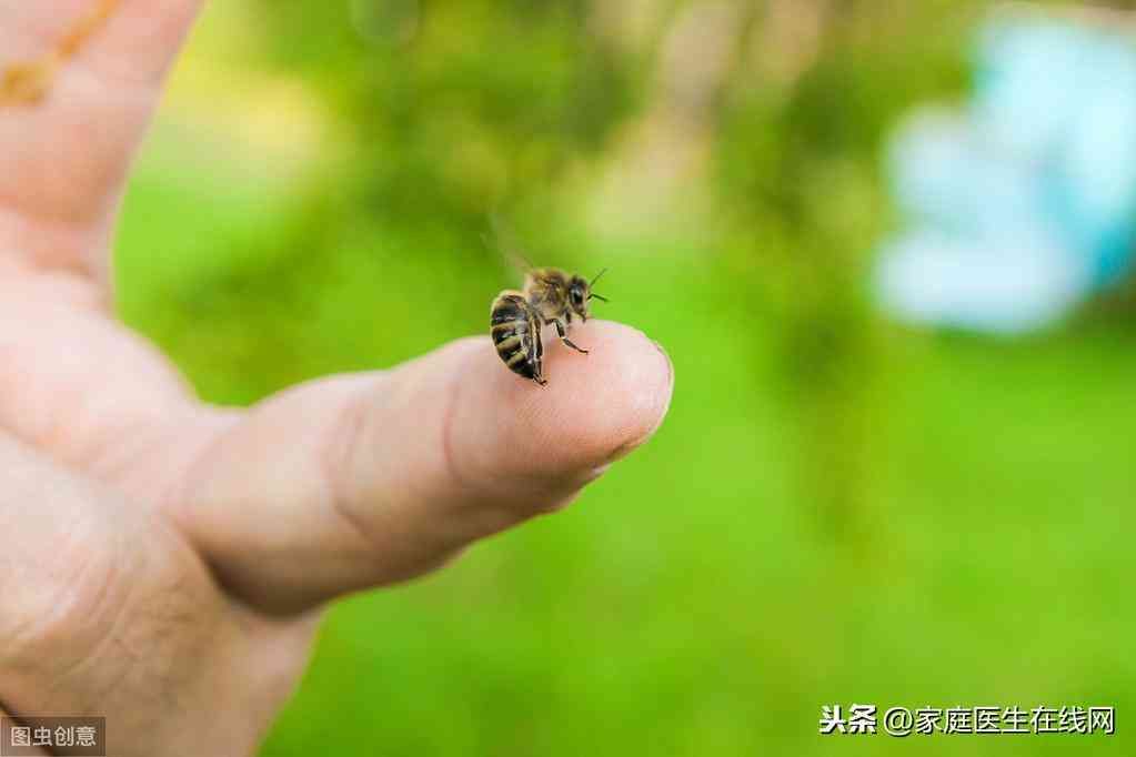 蜜蜂蛰了怎么处理（被蜜蜂蛰了会有毒吗？之后怎么处理？不用担心，做好这3点就行）(图1)